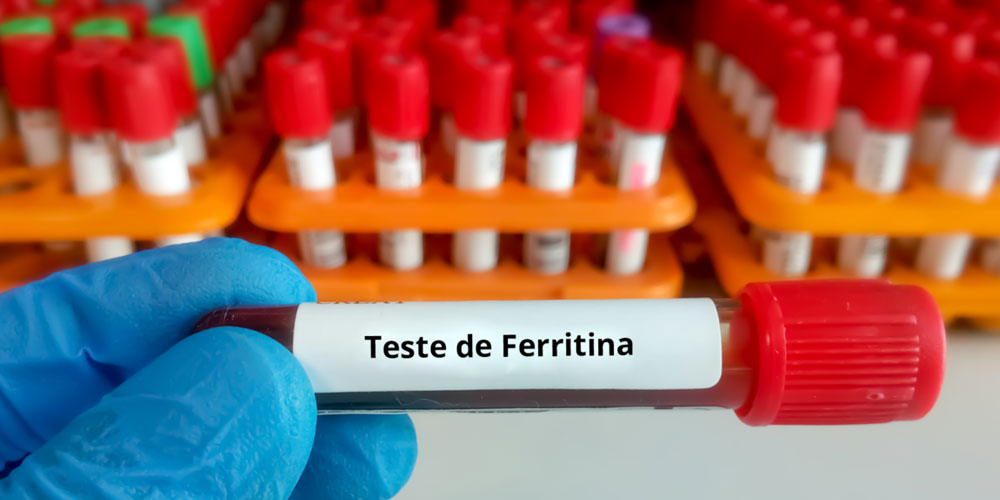 EXAME DE SANGUE DE FERRITINA, NÍVEIS DE FERRITINA, INDICADOR DE SAÚDE, ANEMIA FERROPRIVA, HEMOCROMATOSE, DOENÇAS RELACIONADAS À FERRITINA, METABOLISMO DO FERRO, DIAGNÓSTICO DE DOENÇAS, HEMOGLOBINA E FERRO, INTERPRETAÇÃO DE RESULTADOS