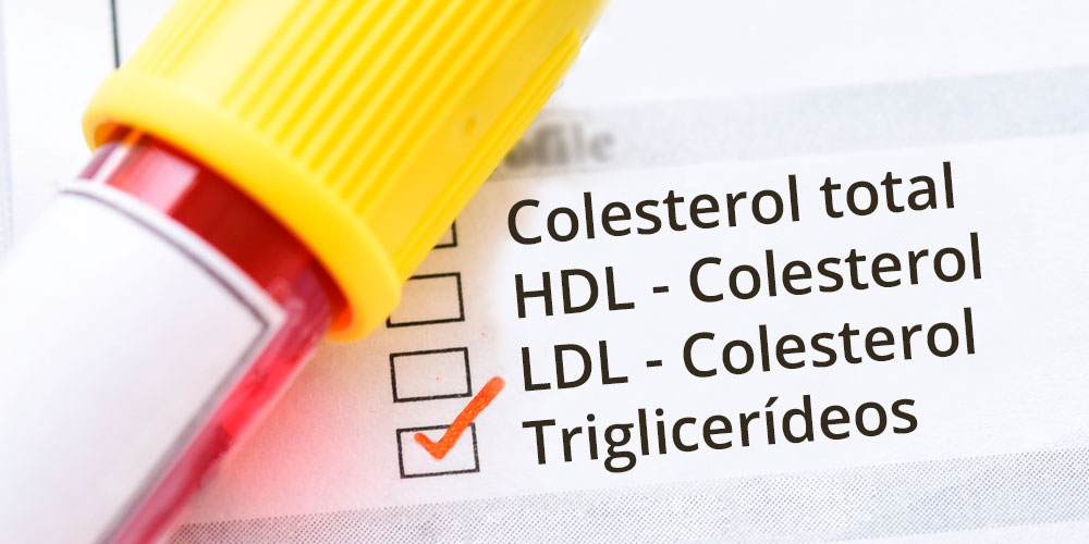 EXAME DE TRIGLICERÍDEOS, SAÚDE CARDIOVASCULAR, METABOLISMO, NÍVEIS IDEAIS, ATEROSCLEROSE, DOENÇA CARDIOVASCULAR, PANCREATITE, DIABETES TIPO 2, ESTEATOSE HEPÁTICA, SÍNDROME METABÓLICA, ORIENTAÇÃO MÉDICA, ESTILO DE VIDA SAUDÁVEL, PROFISSIONAL DE SAÚDE.