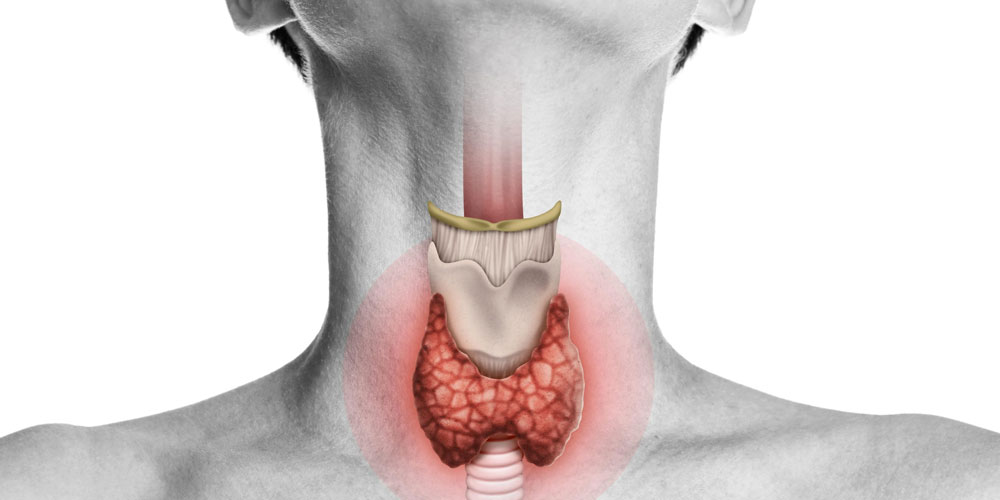 HIPOTIREOIDISMO, DIAGNÓSTICO, TRATAMENTO, GLÂNDULA TIROIDE, HORMÔNIOS TIROIDIANOS, EXAMES DE SANGUE, SINTOMAS, ENDOCRINOLOGIA, LEVOTIROXINA, ACOMPANHAMENTO MÉDICO.