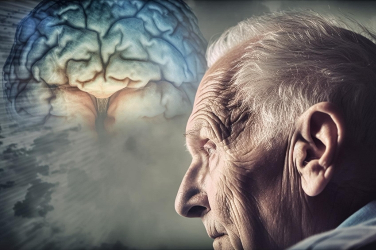 Alzheimer: Entendendo a Doença, Sintomas e Tratamentos