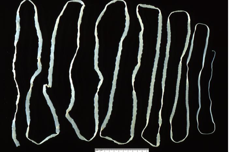 10 sintomas de vermes intestinais