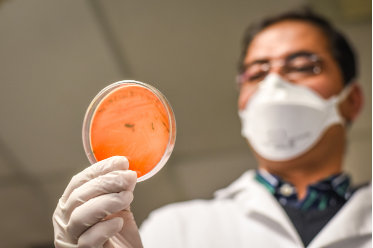 escherichia coli o que é sintomas e como se proteger