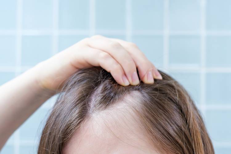 cabelo caindo muito o que fazer