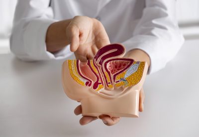 Câncer no Intestino Conhecendo, Prevenindo e Lidando com essa Doença Silenciosa