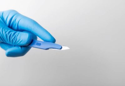 Circuncisão o que é como é feita recuperação e riscos