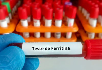 EXAME DE SANGUE DE FERRITINA, NÍVEIS DE FERRITINA, INDICADOR DE SAÚDE, ANEMIA FERROPRIVA, HEMOCROMATOSE, DOENÇAS RELACIONADAS À FERRITINA, METABOLISMO DO FERRO, DIAGNÓSTICO DE DOENÇAS, HEMOGLOBINA E FERRO, INTERPRETAÇÃO DE RESULTADOS