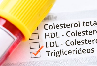 EXAME DE TRIGLICERÍDEOS, SAÚDE CARDIOVASCULAR, METABOLISMO, NÍVEIS IDEAIS, ATEROSCLEROSE, DOENÇA CARDIOVASCULAR, PANCREATITE, DIABETES TIPO 2, ESTEATOSE HEPÁTICA, SÍNDROME METABÓLICA, ORIENTAÇÃO MÉDICA, ESTILO DE VIDA SAUDÁVEL, PROFISSIONAL DE SAÚDE.