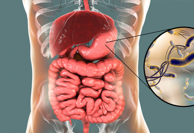 H. pylori O Que É e Como É Identificado