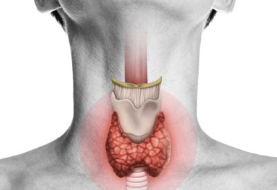 HIPOTIREOIDISMO, DIAGNÓSTICO, TRATAMENTO, GLÂNDULA TIROIDE, HORMÔNIOS TIROIDIANOS, EXAMES DE SANGUE, SINTOMAS, ENDOCRINOLOGIA, LEVOTIROXINA, ACOMPANHAMENTO MÉDICO.