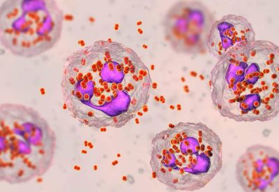 eosinófilos altos ou baixos