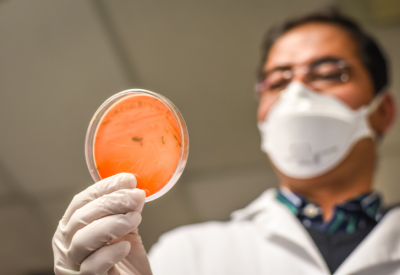 escherichia coli o que é sintomas e como se proteger