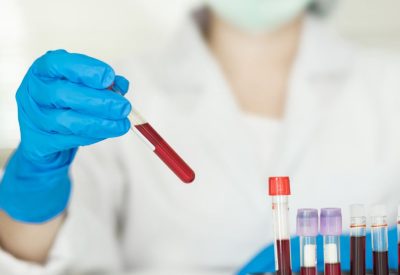 Exame de sangue, Gravidez, Teste de gravidez, HCG, Exame de sangue para gravidez, Confirmação de gravidez, Exame qualitativo, Exame quantitativo, Exame de sangue beta-HCG, Exame de sangue para detecção de gravidez, Exame de sangue para confirmar gravidez, Exame de sangue de laboratório, Exame de sangue de gravidez precoce, Exame de sangue de gravidez seguro, Exame de sangue para identificação de gravidez, Exame de sangue para acompanhar a gravidez, Exame de sangue para monitorar HCG, Exame de sangue para gravidez ectópica, Exame de sangue confiável para gravidez, Exame de sangue de laboratório para gravidez.